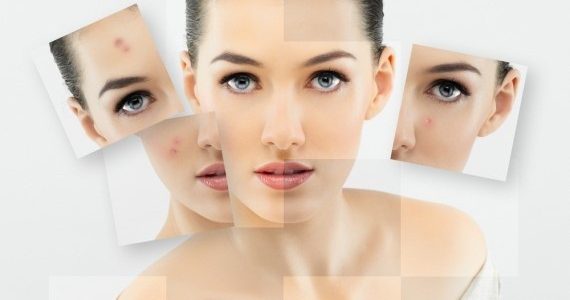 تعرفي على الأنواع المختلفة للبشرة