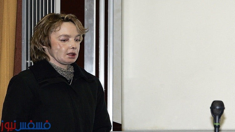 عملية زرع الوجه