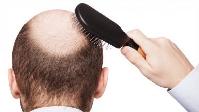 زراعة الشعر