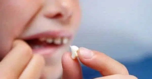 تفسير حلم وقوع الضروس