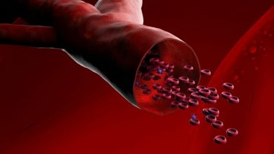 اضرار نقص الحديد في الجسم 11 اضرار نقص الحديد في الجسم